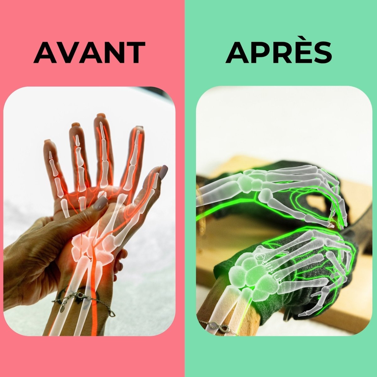Gants de Mobilité Cellsius - Libérez vos mains de la douleur